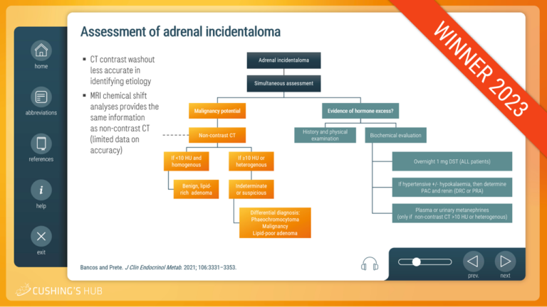 An interactive case study on adrenal incidentalomas and mild autonomous cortisol secretion (MACS)